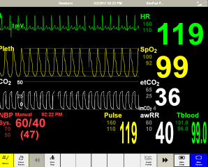 Patient Monitor Options LLEAP and SimPad PLUS