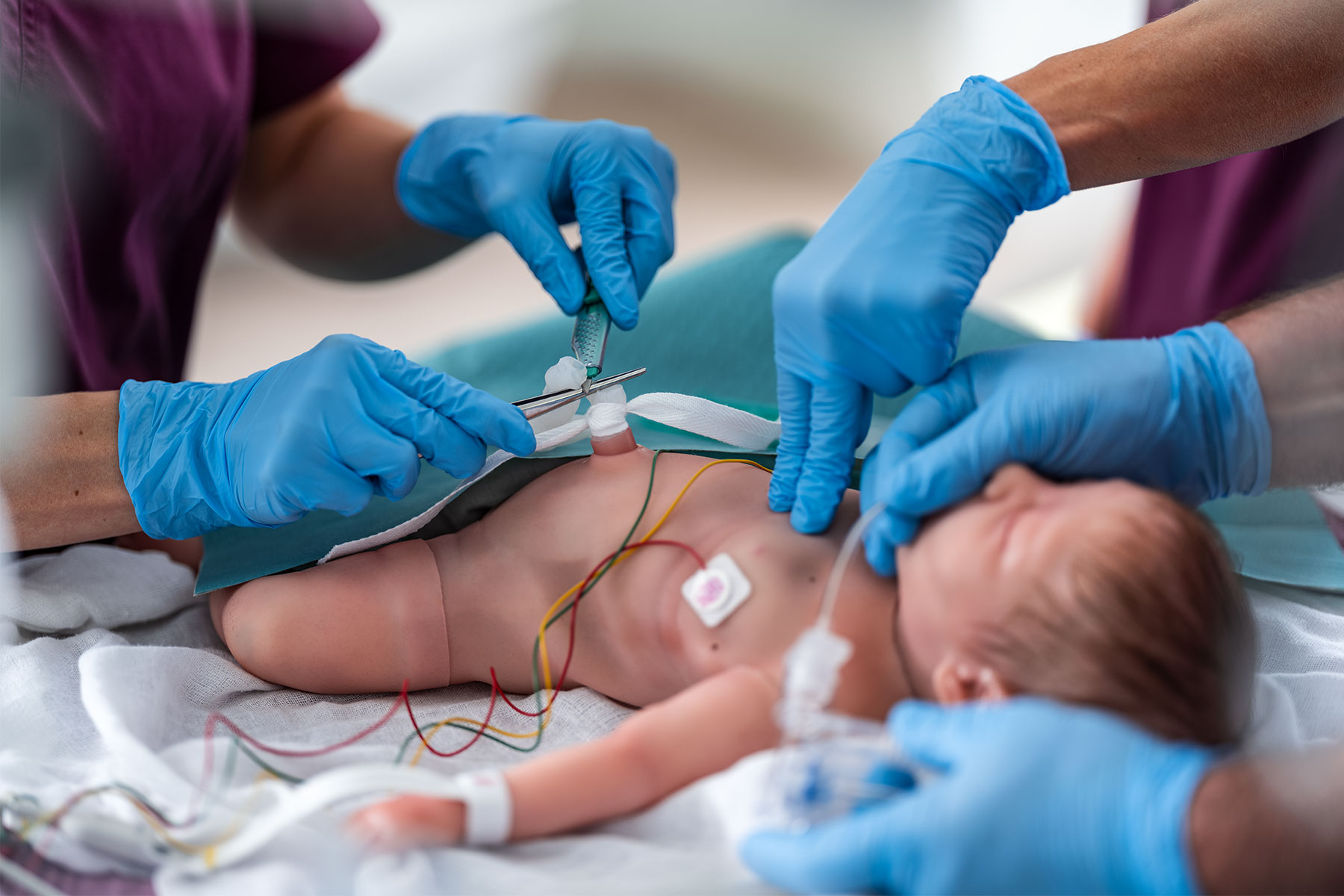 Emily w rękach neonatologów