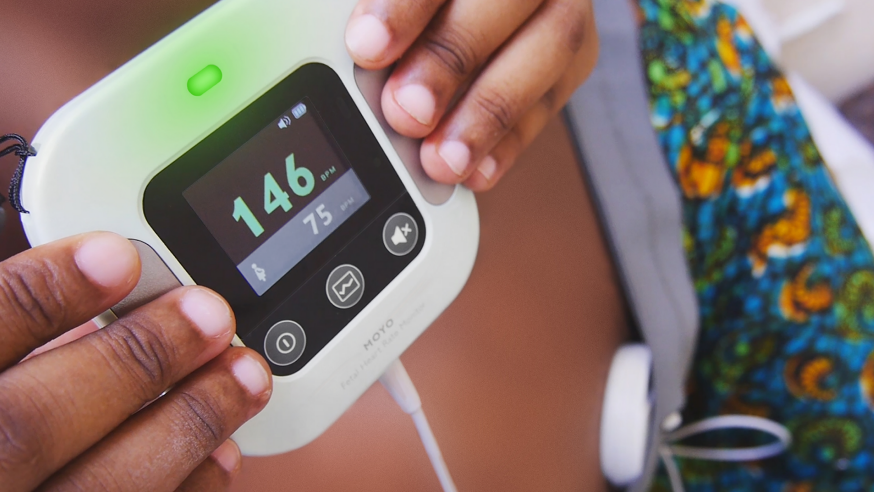 Moyo - Fetal Heart Rate Monitor