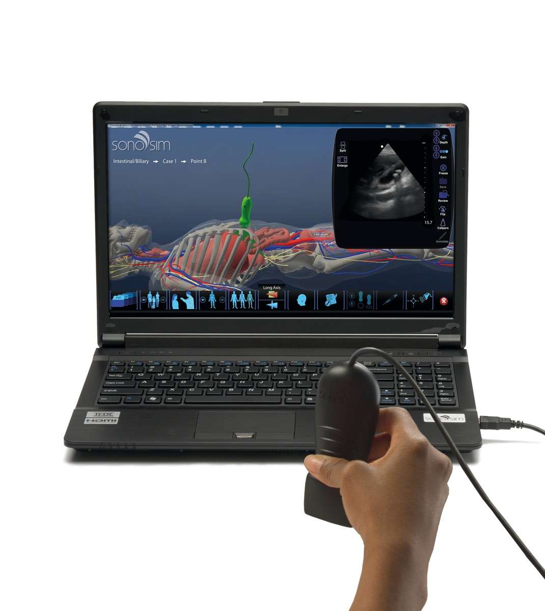 SonoSim® Ultraschall-Ausbildungslösung