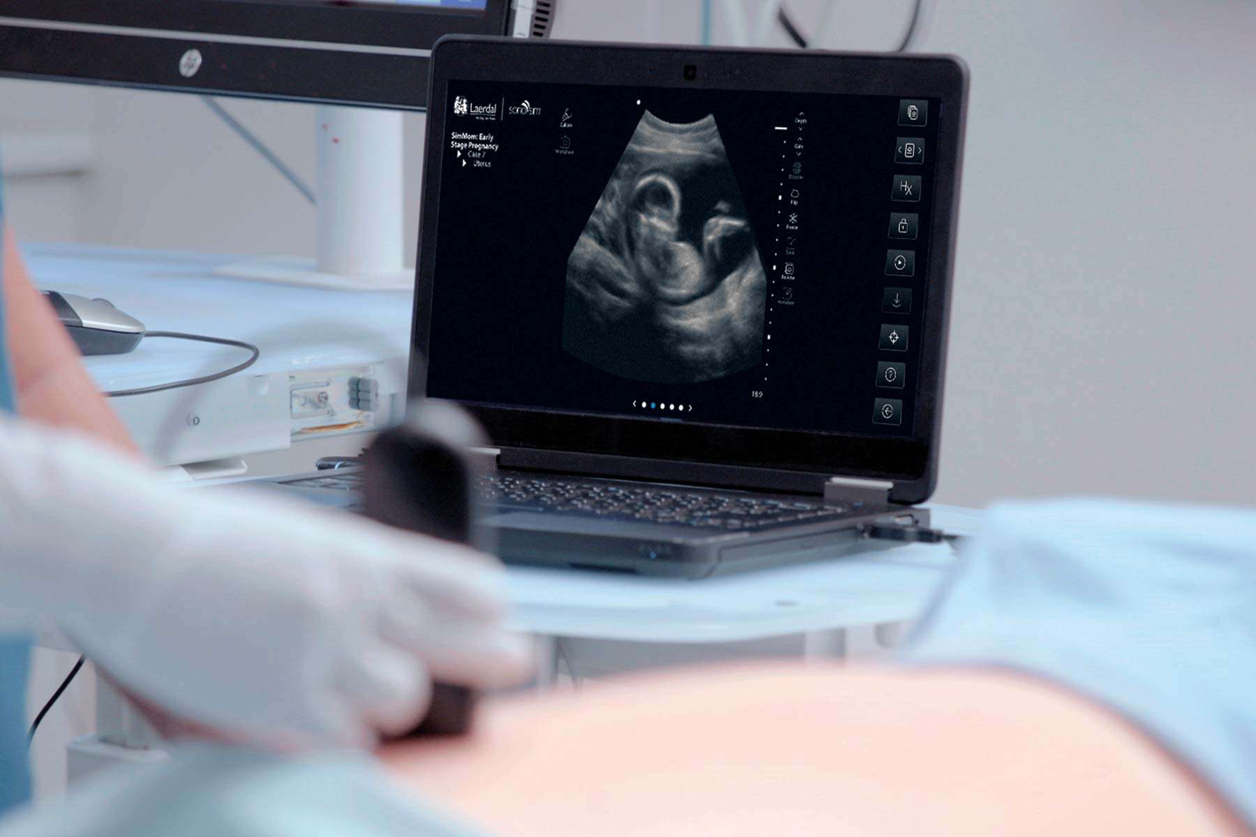 Ultrasound Skills Trainer