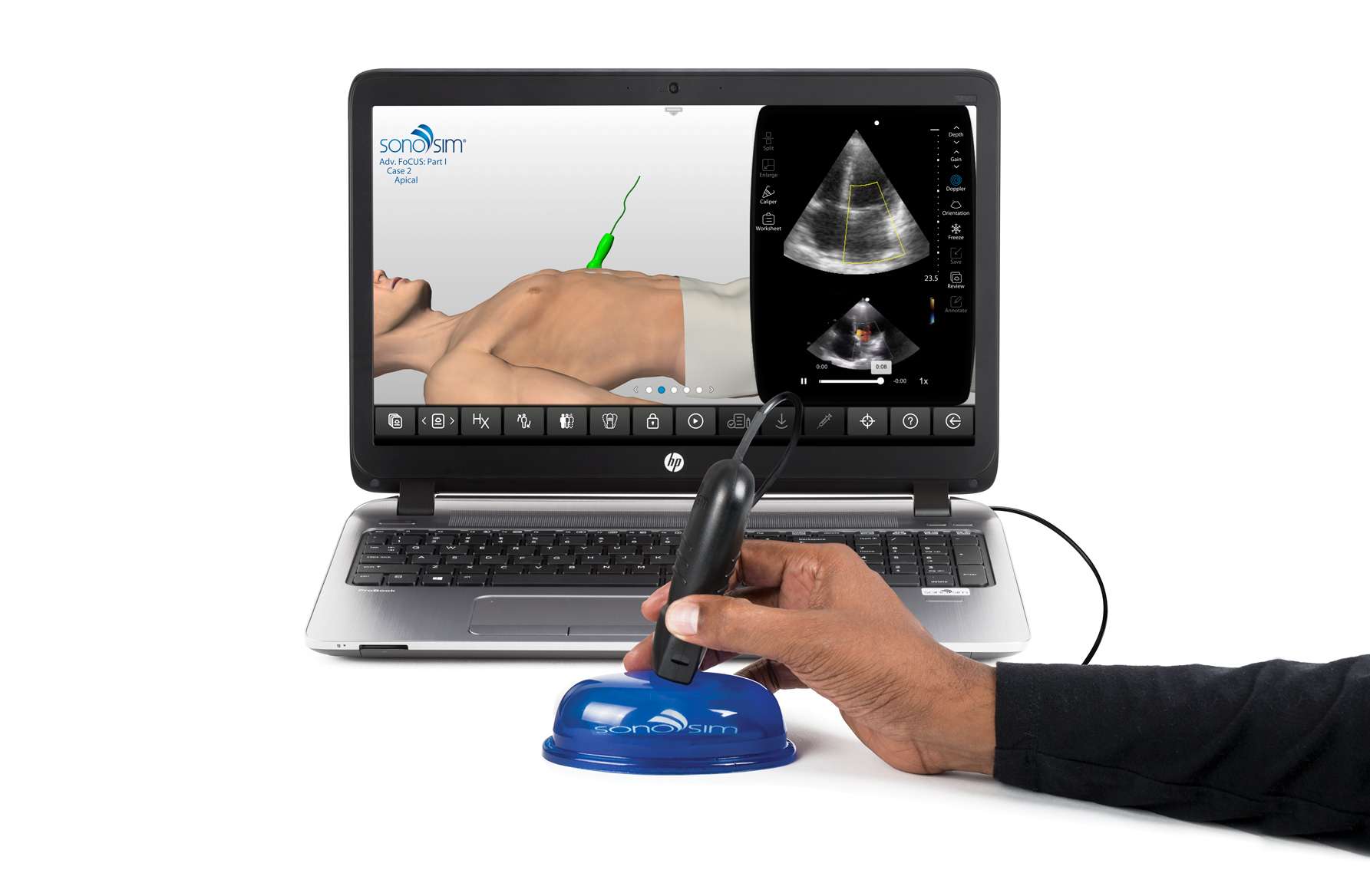 SonoSim Ultrasound Training Ecosystem