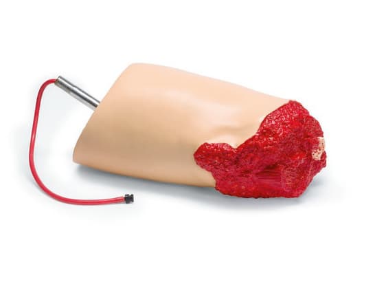 Amputated Leg SimMan 3G