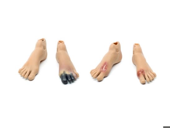 Staged Wound Feet Set-M NAS