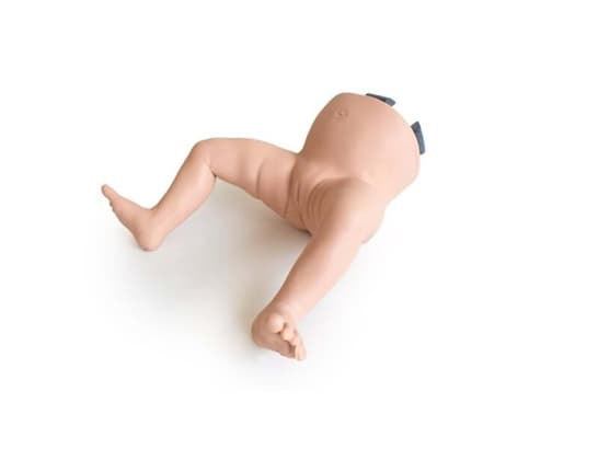 Infant Hip Exam - Lower Abnormal - Light