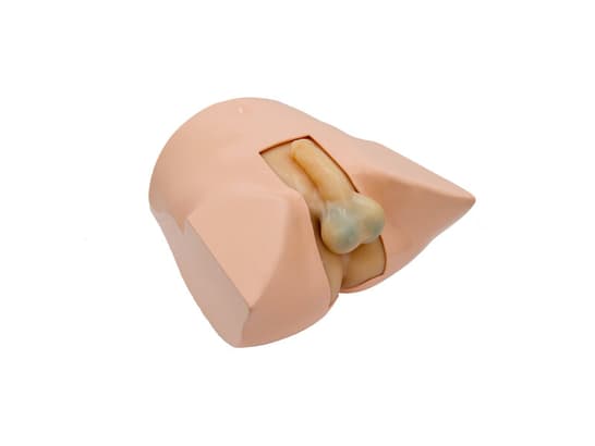 Scrotum & Prostrate US With skin