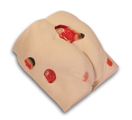 WOUND CARE MODEL SEYMOUR II