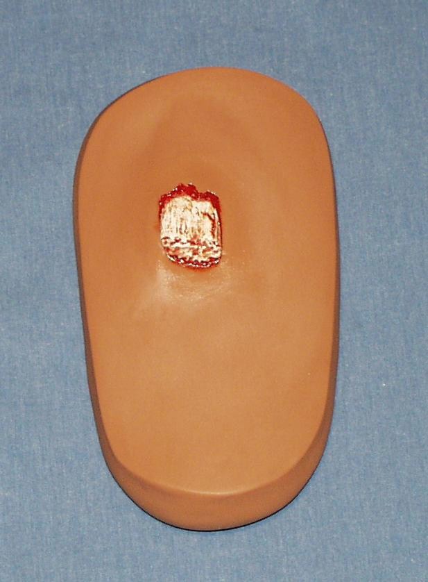 PAD; THIGH-OPEN FRAC-TAN ADULT PAINTED