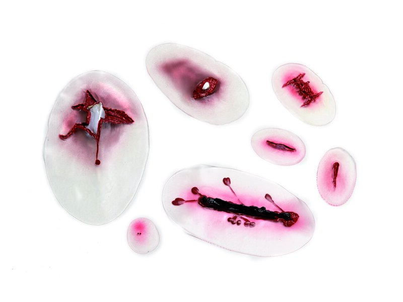 Wound selection 2