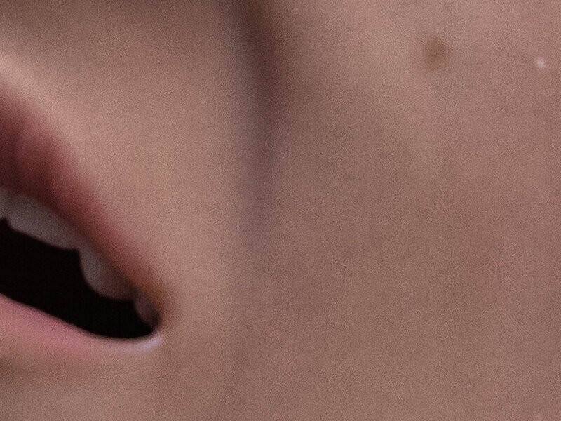 SimMan Critical Care-B Medium NIBP Stud Defib