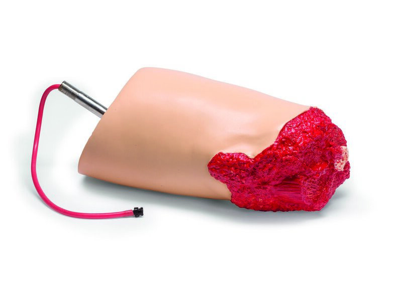 Amputated Leg SimMan 3G