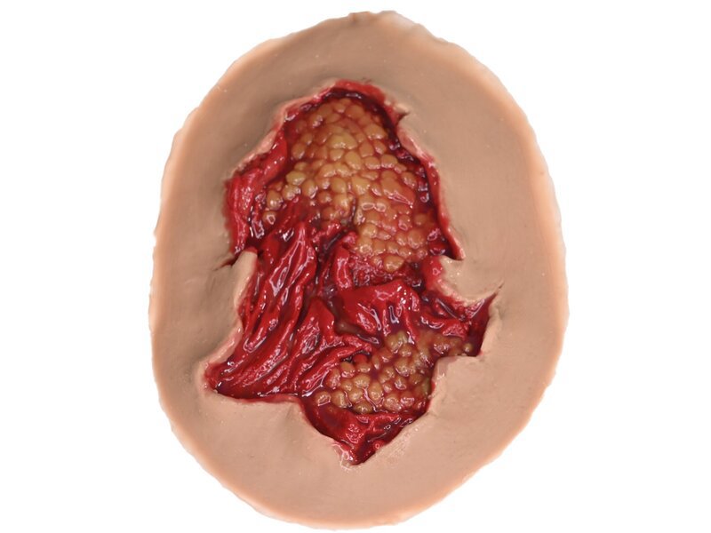 Deep Abrasion - Laerdal Medium