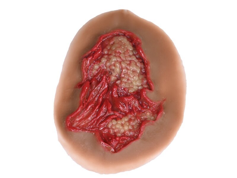 Deep Abrasion - Laerdal Dark