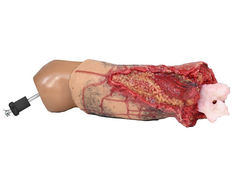 Complete Medium left arm Amputation with Core