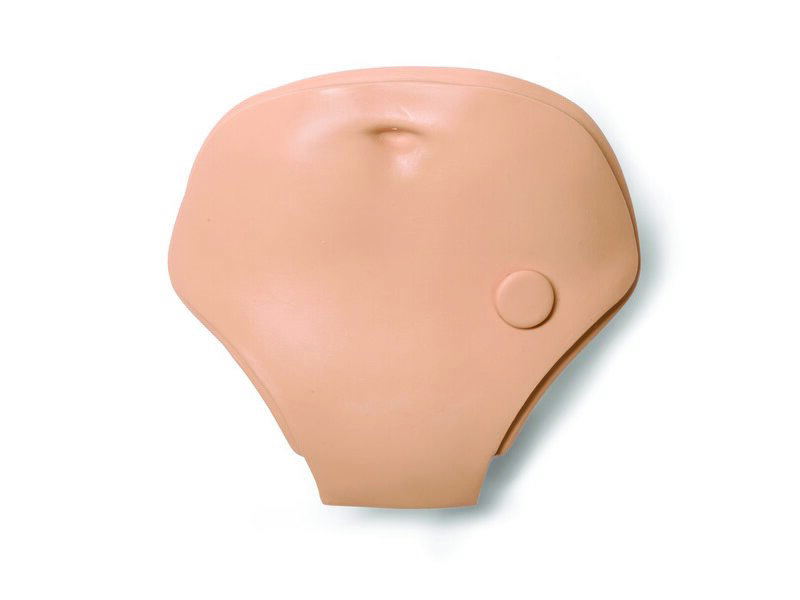 ABD PLATE; FEMALE 1 HOLE STD