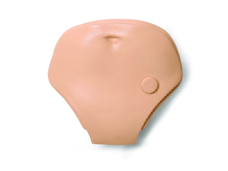 ABD PLATE; FEMALE 1 HOLE STD