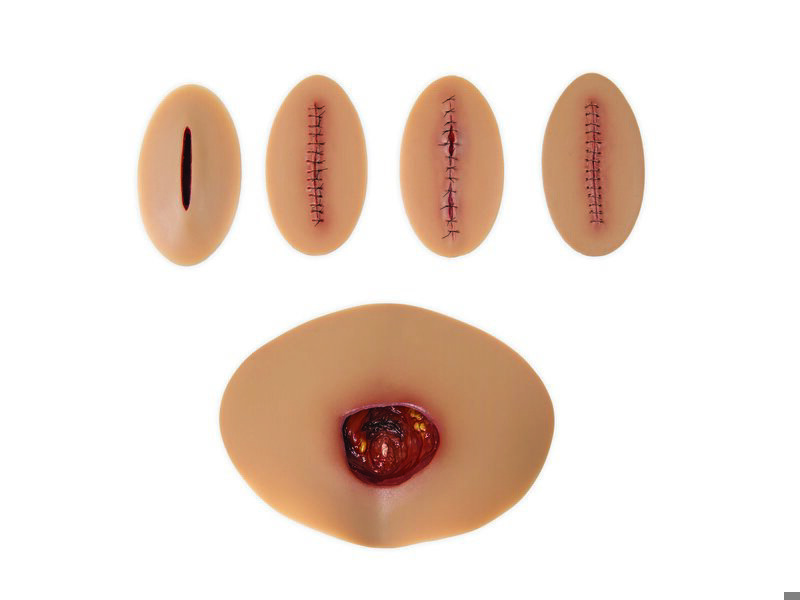 Wound Assess Care Kit-M Nursing Anne Simulator