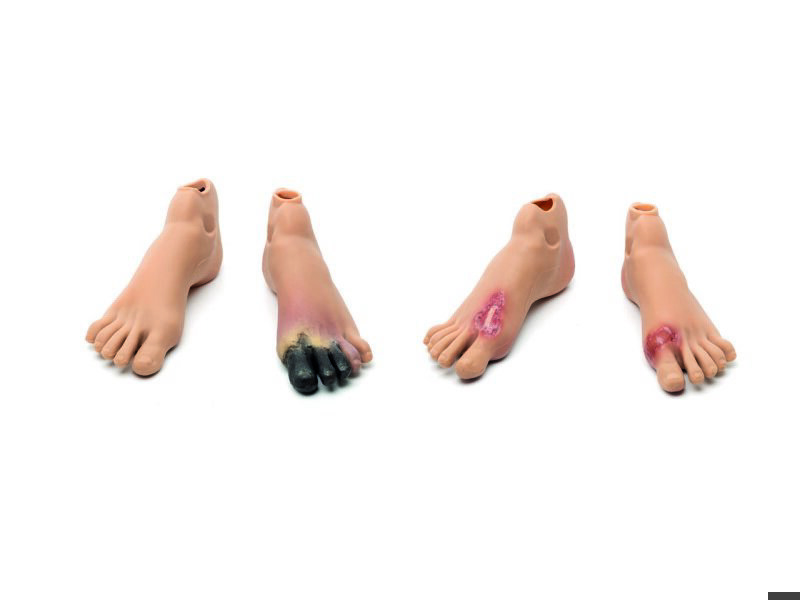 Staged Wound Feet Set-M NAS