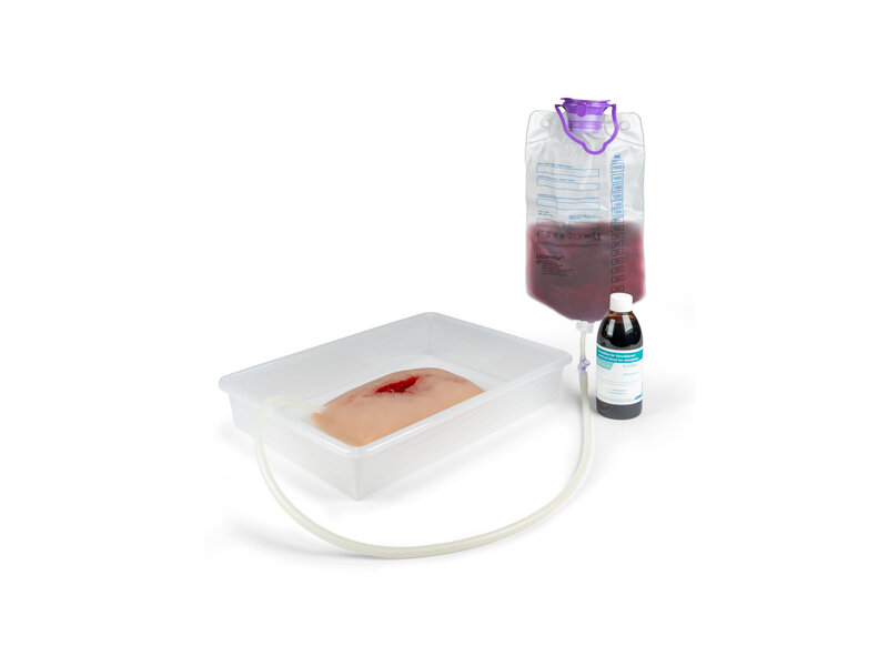 Wound Packing Wound Moulage