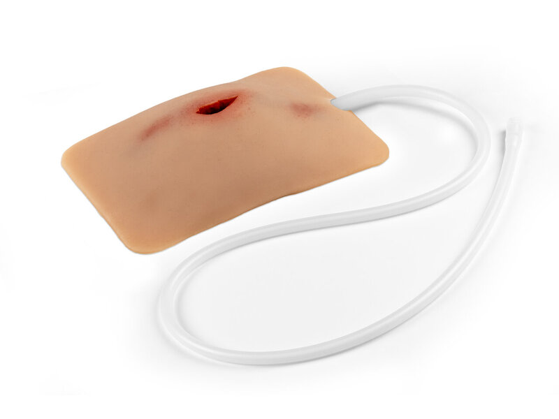Wound Packing Stab
