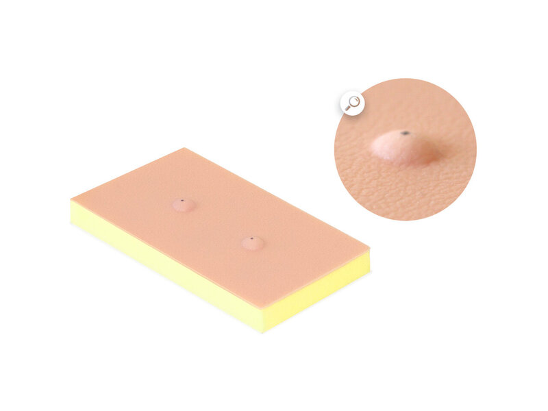 Sebaceous Cyst Pad