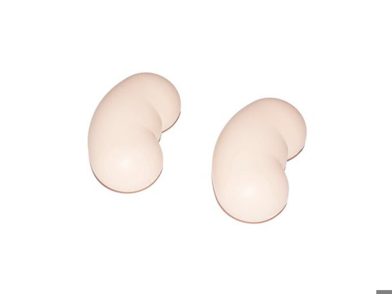 Enlarged Kidneys 2 set for Examination Trainer