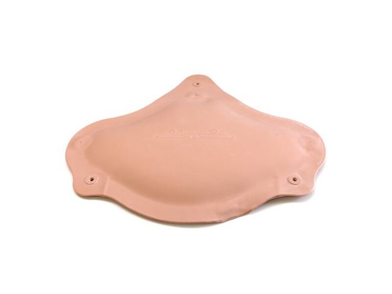 Abdominal Examination Ascites Bag