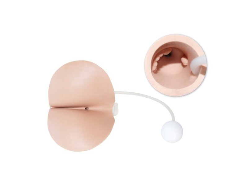 Pathological Perineum Male Rectal Exam Trnr