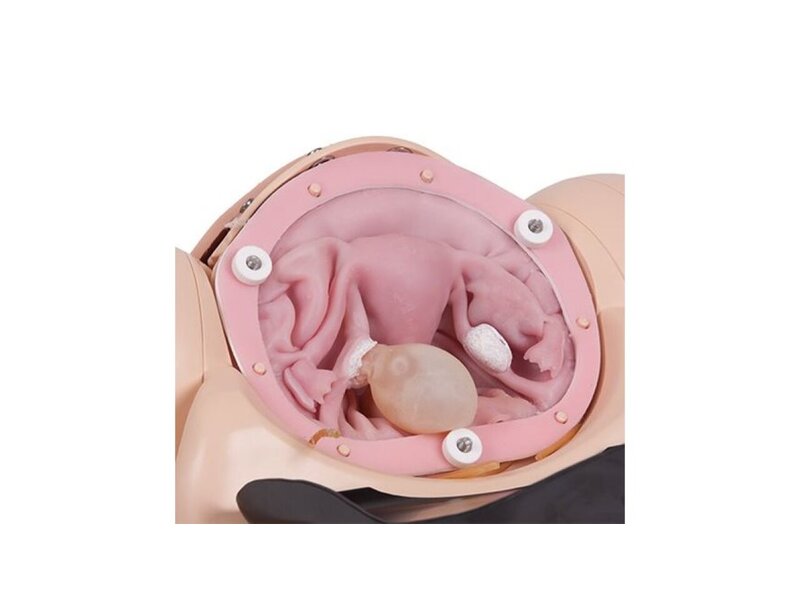 SFPT Mk 2 Uterus