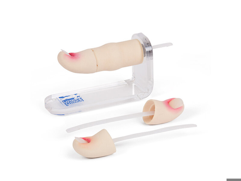 Ingrowing Toenail Trainer