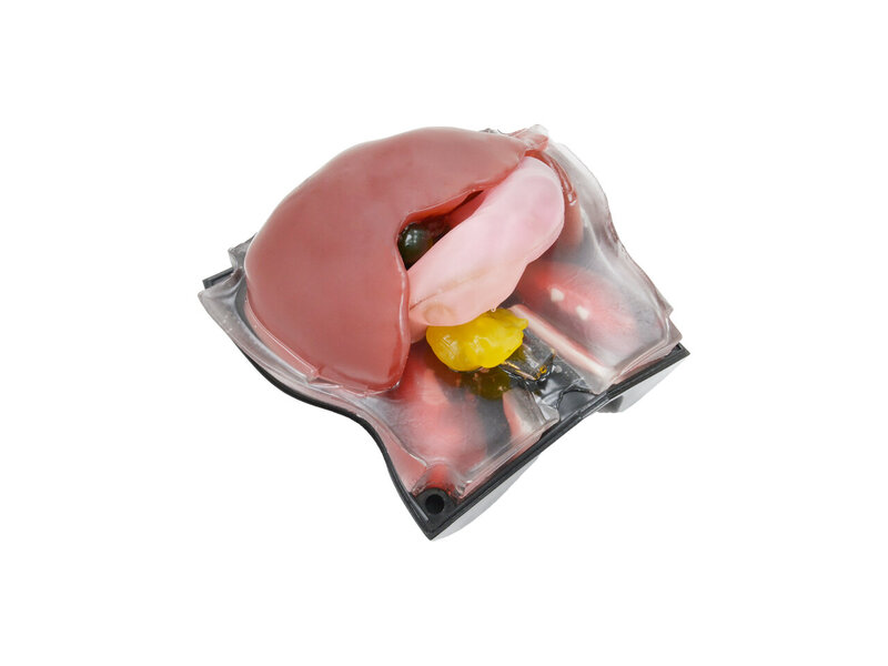 Abdominal Intraoperative & Laparoscopic Ultrasound Diagnosis Model (Opaque, With Lesions)
