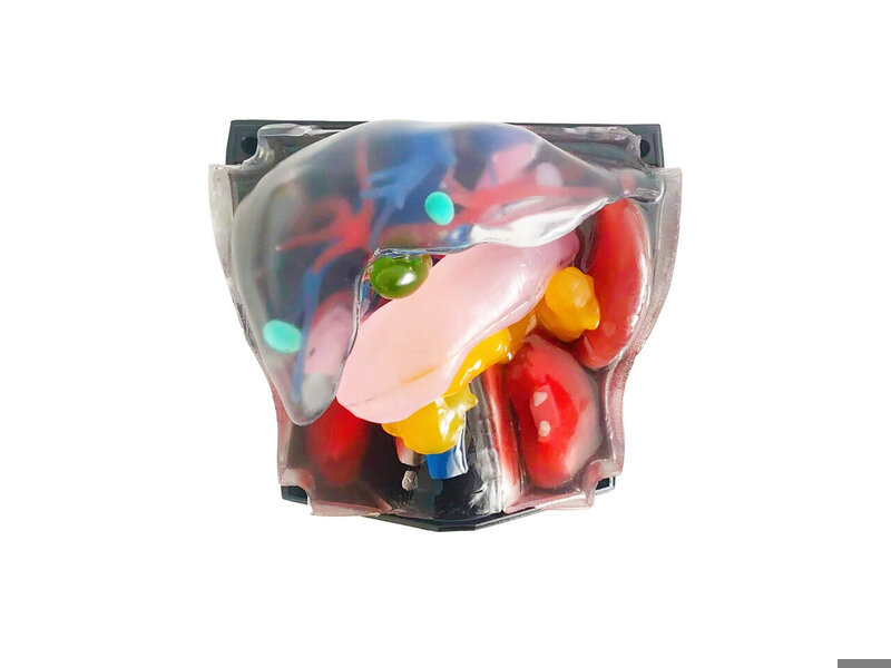 Abdominal Intraoperative & Laparoscopic Ultrasound Diagnosis Model (Transparent, With Lesions)