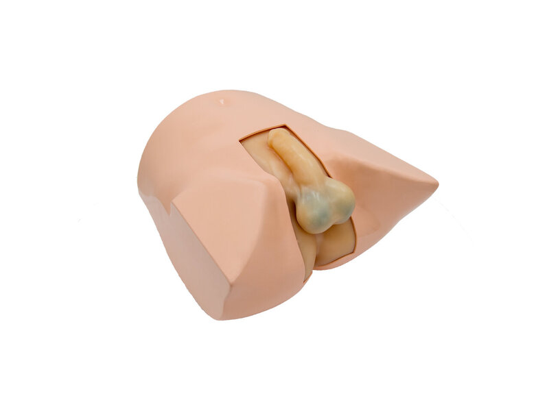 Scrotum & Prostrate US With skin