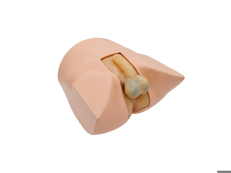 Scrotum And Prostate Ultrasound Examination Model (Skin colored)