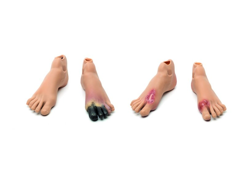 Staged Wound Feet Set (Med) Nursing Anne Simulator